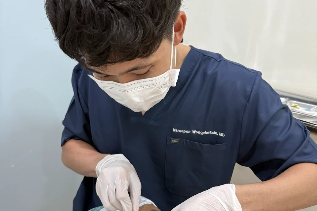 คุณหมอเอกกำลังกำจัดไฝให้ผู้รับบริการ